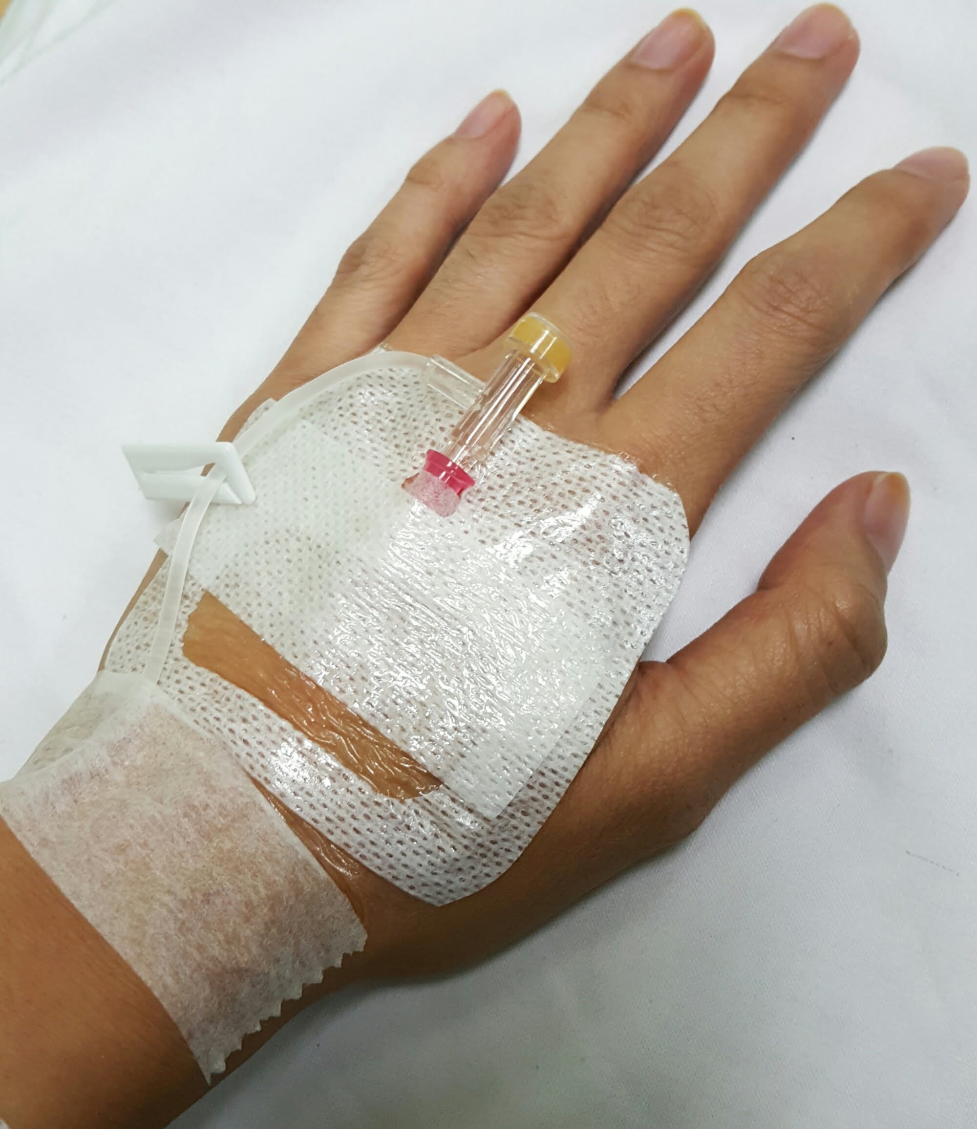 wptak-jangka-kena-admit-hospital-part-1 image