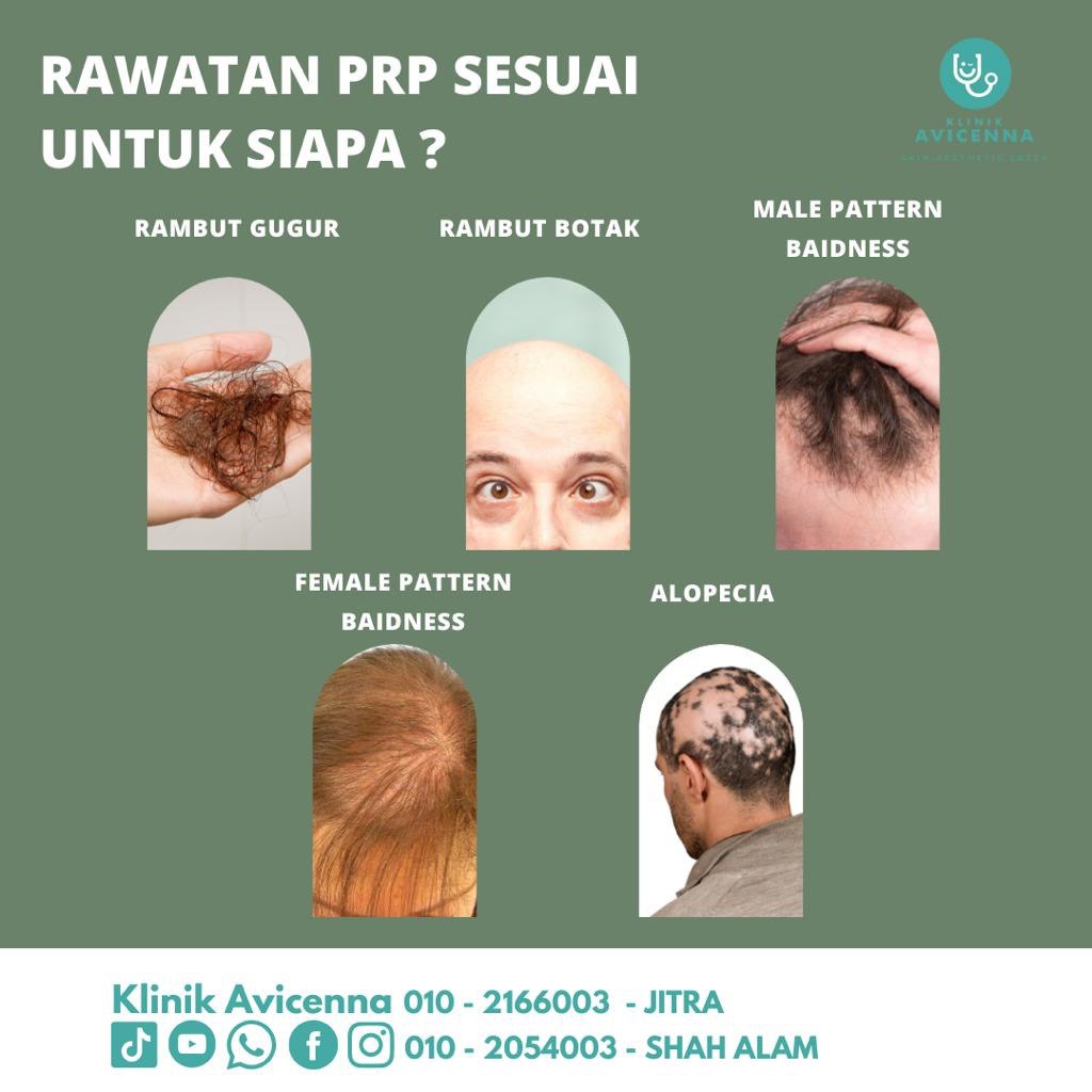 MASALAH RAMBUT GUGUR : KENAPA RAMBUT GUGUR BANYAK SETIAP HARI?