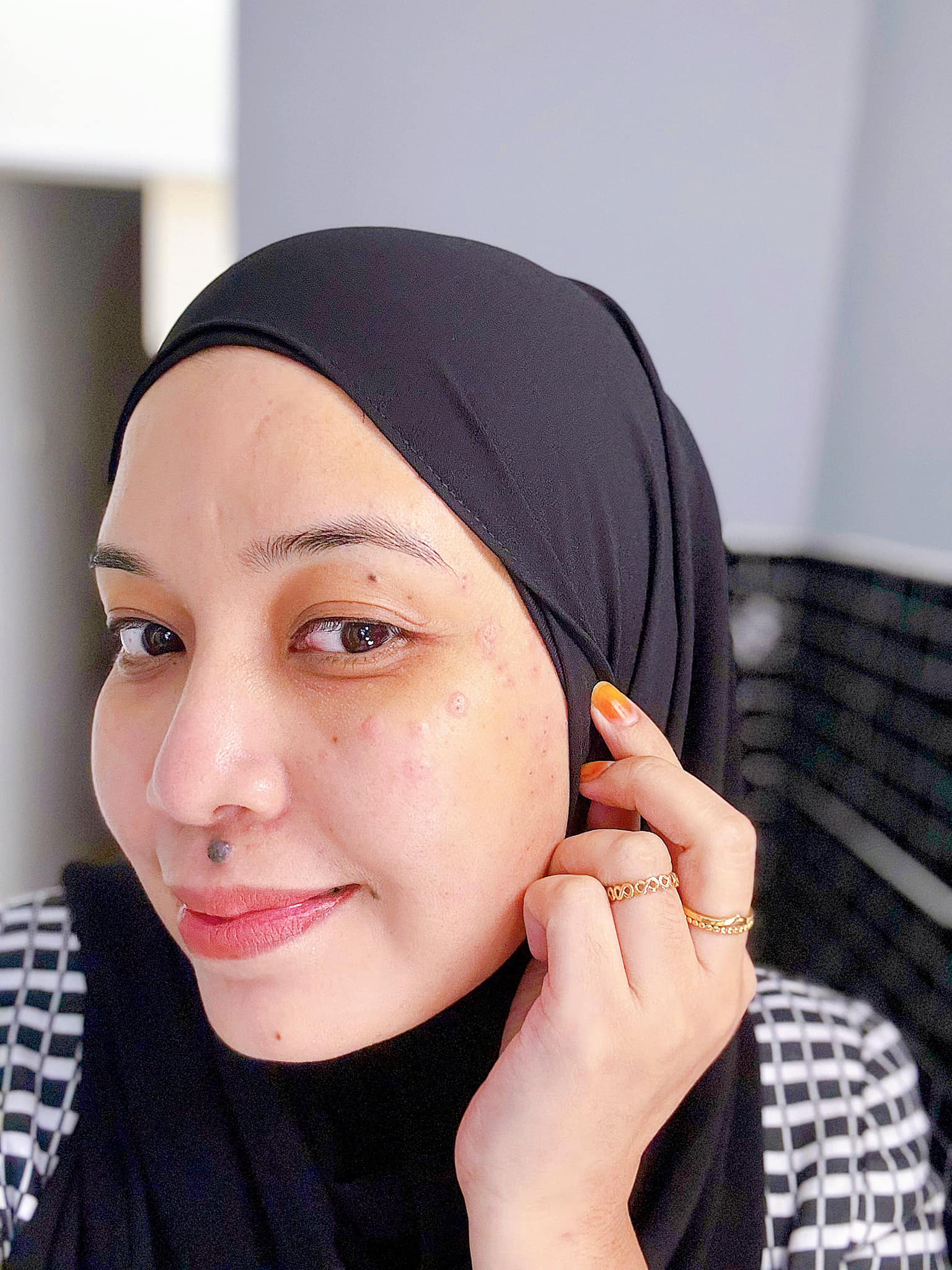 buang kutil muka