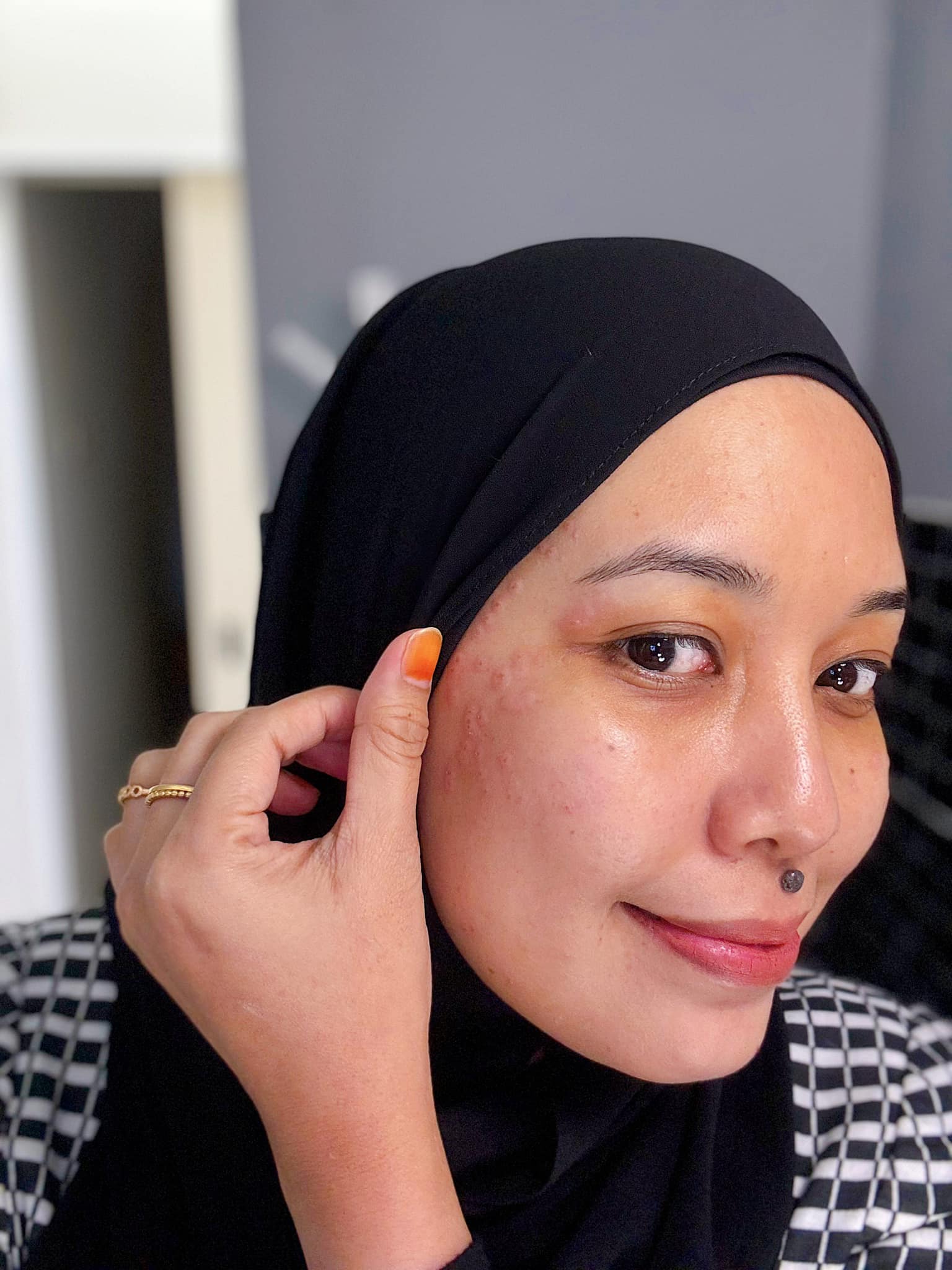 buang kutil muka