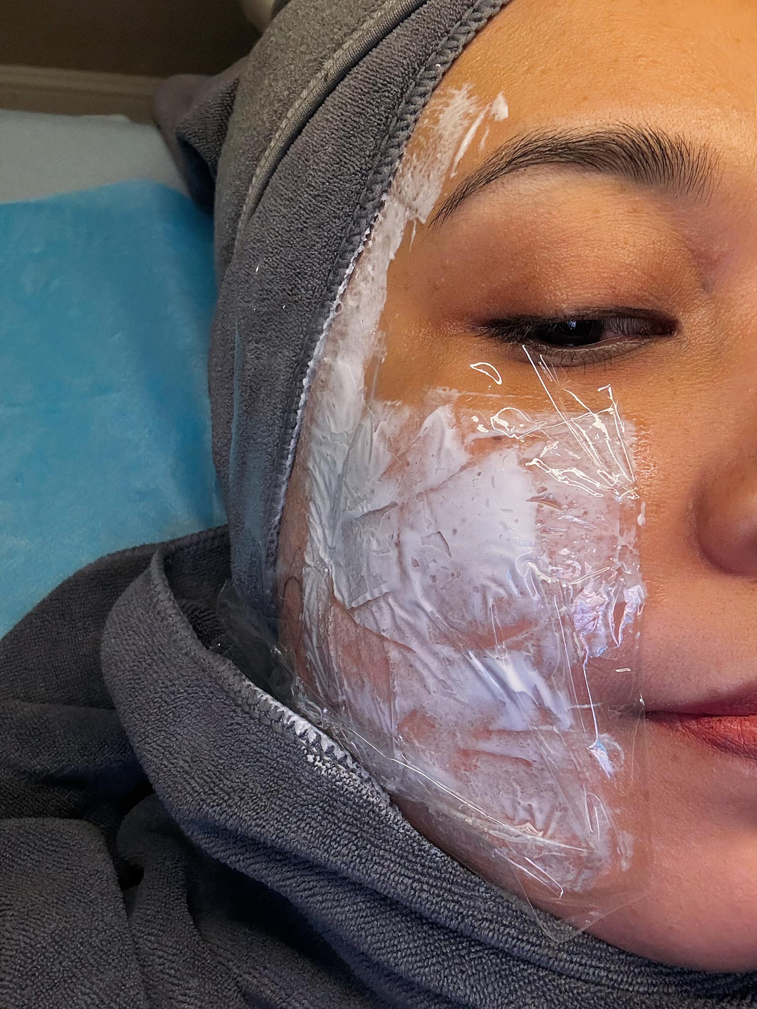 buang kutil mukabuang kutil muka