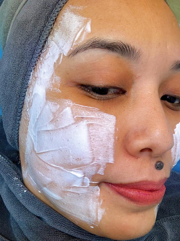 buang kutil muka