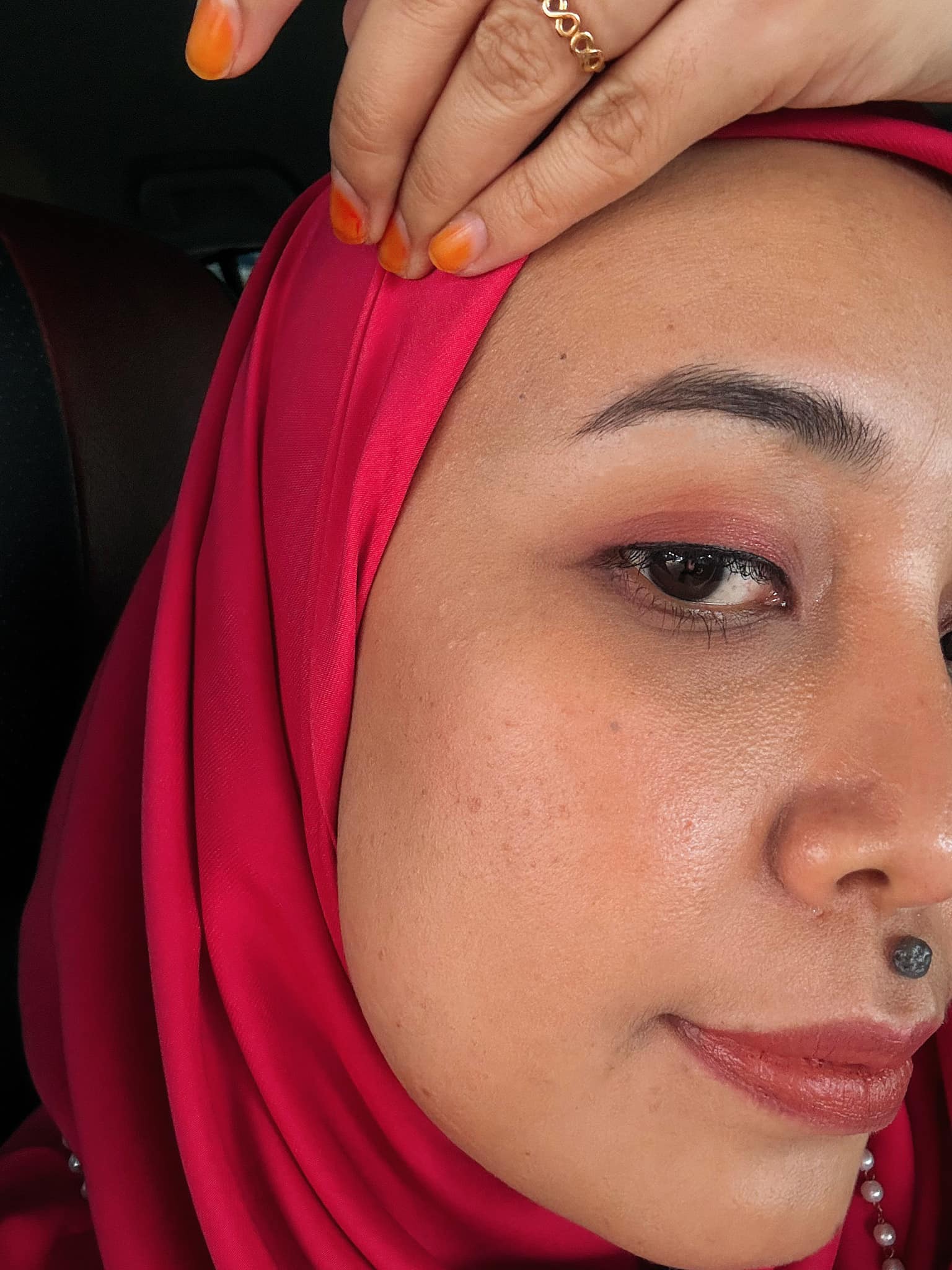 buang kutil muka